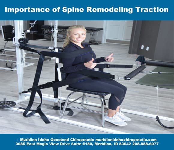 Image with text Importance of Spine Remodeling TractionChiropractic Care Post-Spinal Surgery