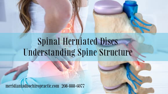 Image showing spinal herniated discs