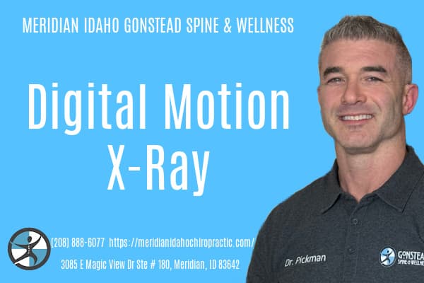 How Meridian ID Gonstead Chiropractic Uses Digital Motion X-Ray