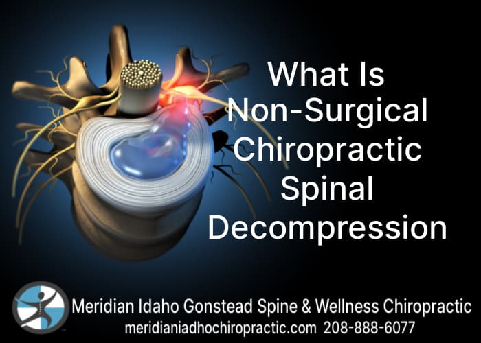 Image of A Herniated disc needing Chiropractic Spinal decompression